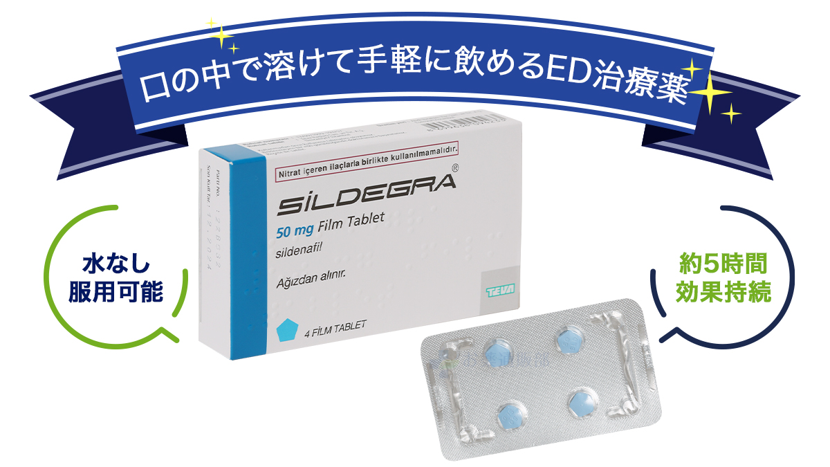 シルデグラの特徴