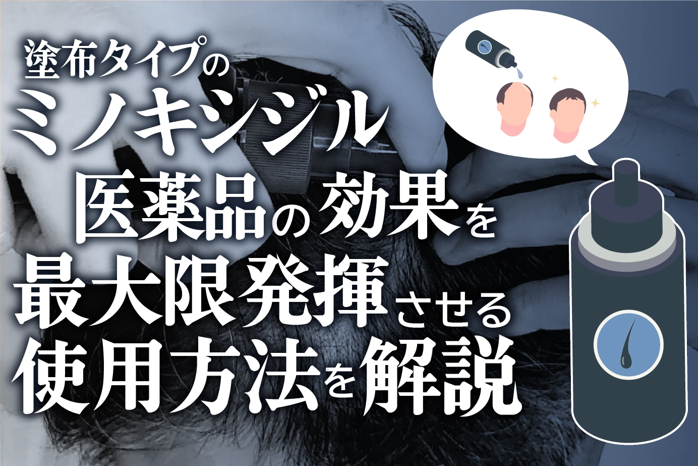 AGA(壮年性脱毛症)治療薬「ミノキシジル」の効果的な使用方法とは?