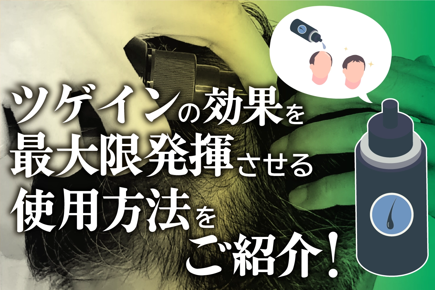 いつどれくらい使用すればいい?AGA(壮年性脱毛症)治療薬ツゲインの使用方法を解説