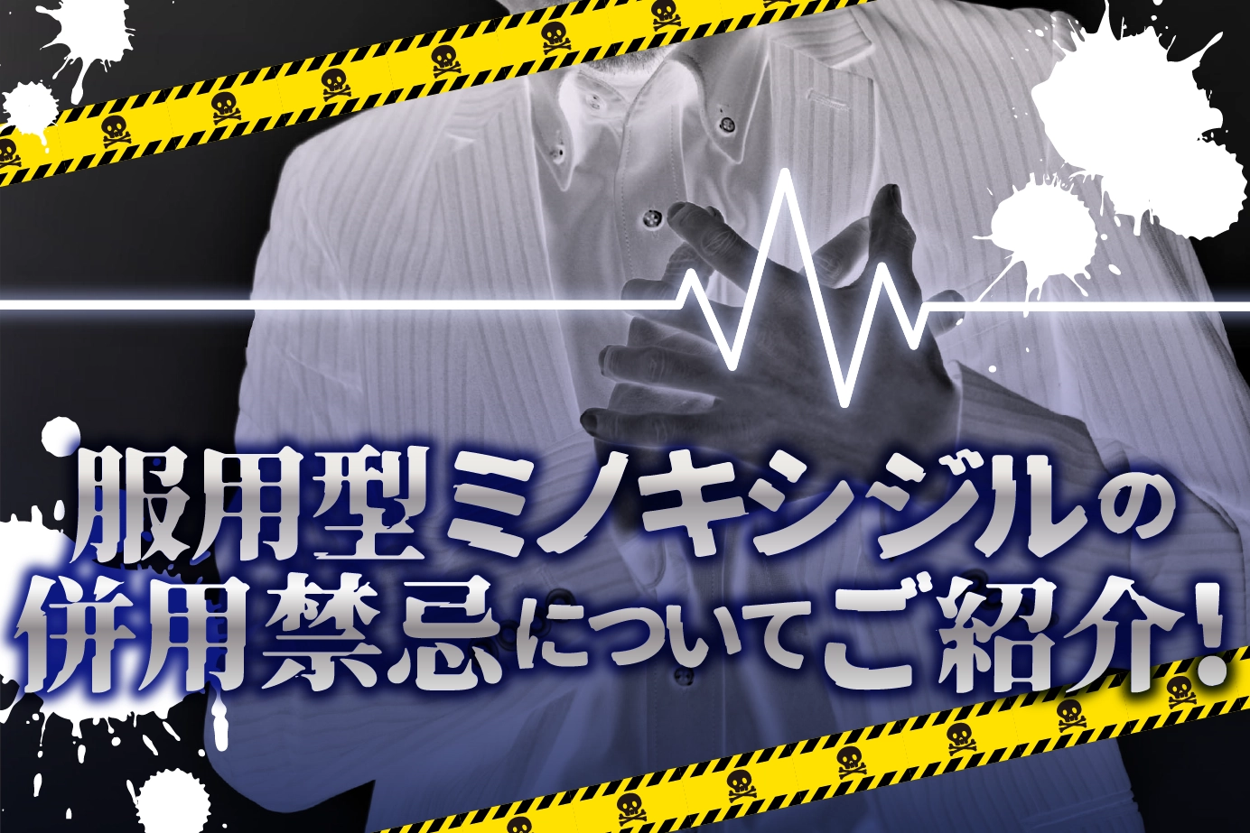 ミノキシジルと併用禁忌:知られていない危険性