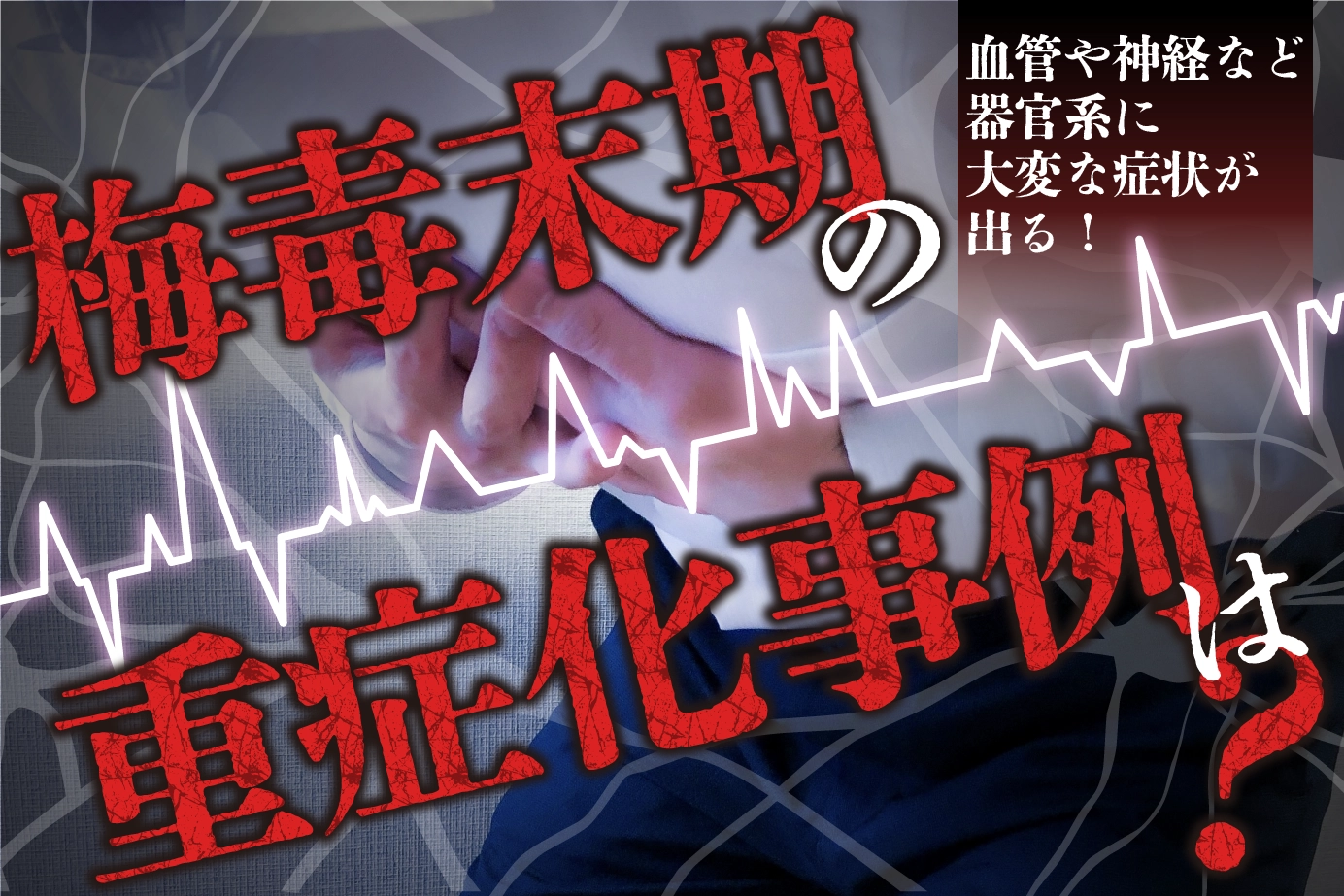 梅毒末期の重症化事例は?血管や神経など器官系に大変な症状が出る!