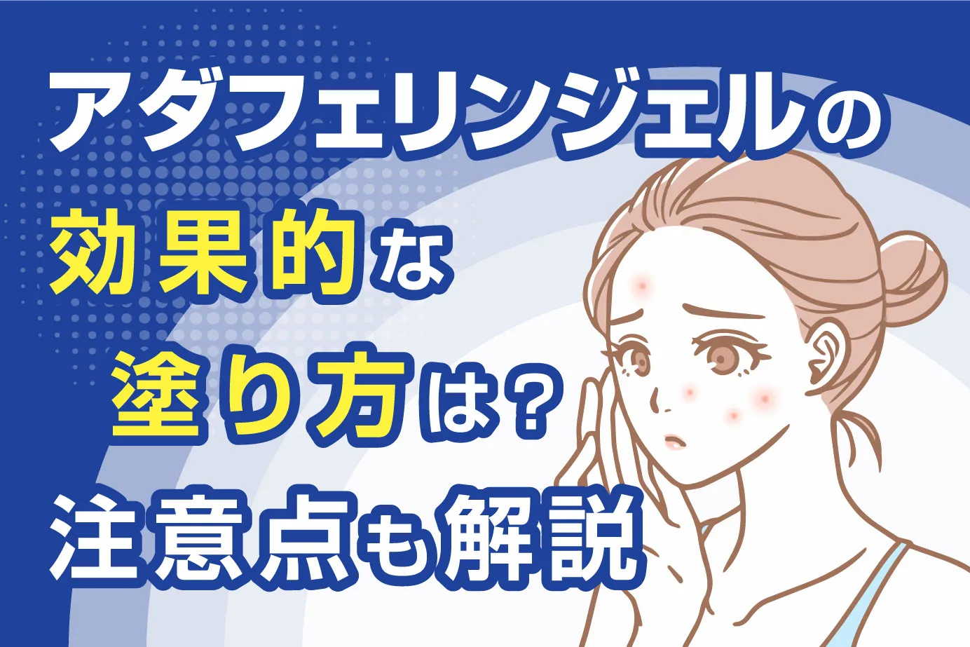 アダフェリンジェルの効果的な塗り方は？注意点も解説