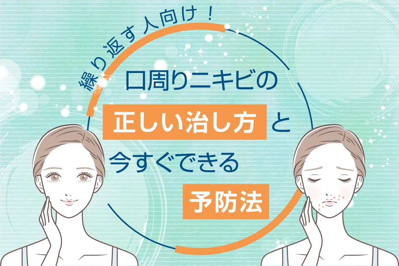 口周りニキビを繰り返す人向け!正しい治し方と今すぐできる予防法