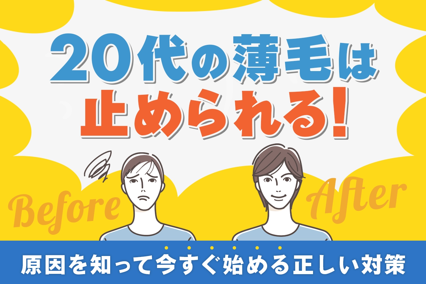 20代の薄毛は止められる!原因を知って今すぐ始める正しい対策