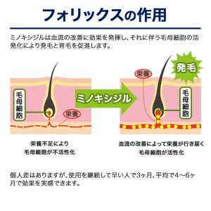 フォリックス画像8