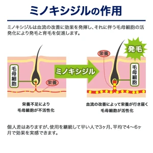 モールエフ画像8