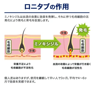 ロニタブ画像9