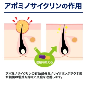 アポミノサイクリン画像6