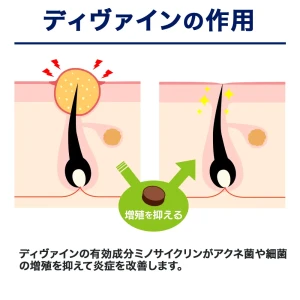 ディヴァイン画像8