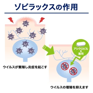 ゾビラックス画像8
