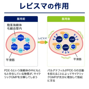レビスマ画像9
