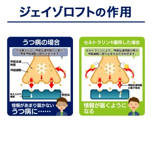 ジェイゾロフト画像8