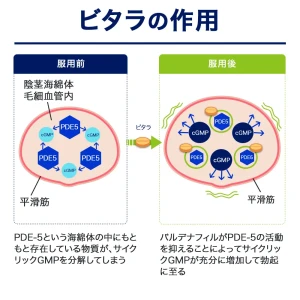 ビタラ画像7