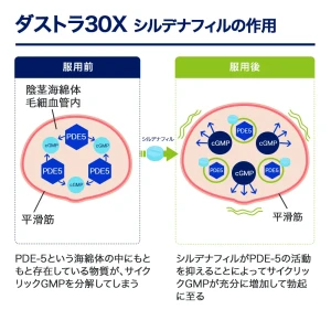 ダストラ30X画像8