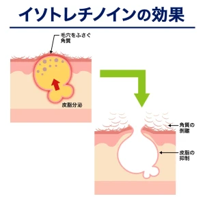 トレティヴァ画像8