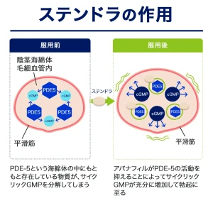 ステンドラ画像9