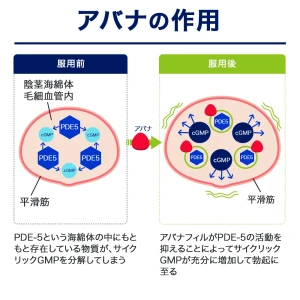 アバナ画像8