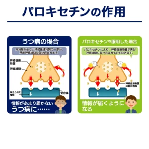 パロキセチン画像7