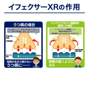 イフェクサーXR画像7