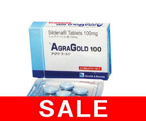 【SALE】アグラゴールド