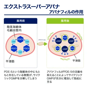 エクストラスーパーアバナ画像8