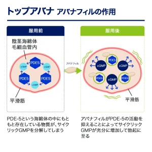トップアバナ画像8