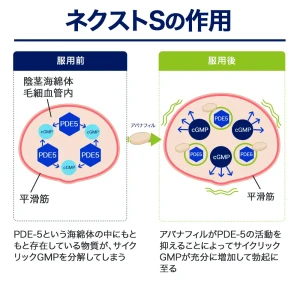 ネクストS（ステンドラ・ジェネリック）画像8
