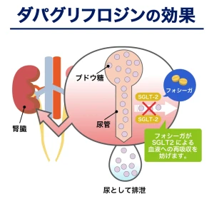 フォシーガ画像7