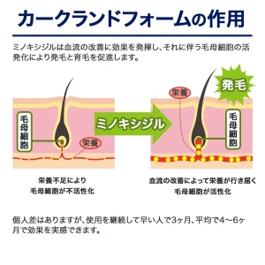 カークランドフォーム画像7