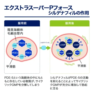 エクストラスーパーPフォース画像8
