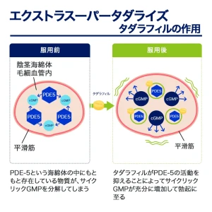 エクストラスーパータダライズ画像6