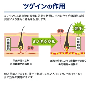 フィナクス（200錠）+ツゲイン（6箱）画像10