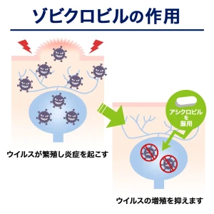 ゾビクロビル画像7