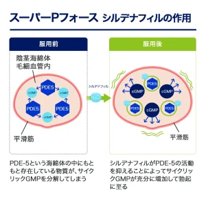 スーパーPフォース画像8