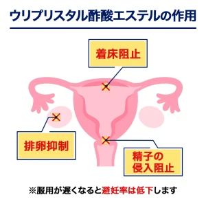 エラ画像6