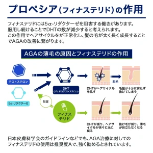 プロペシア画像9
