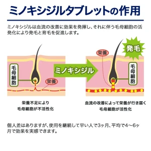 ミノキシジルタブレット画像9