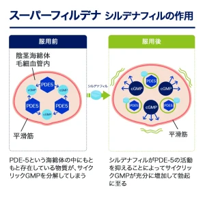 スーパーフィルデナ画像8